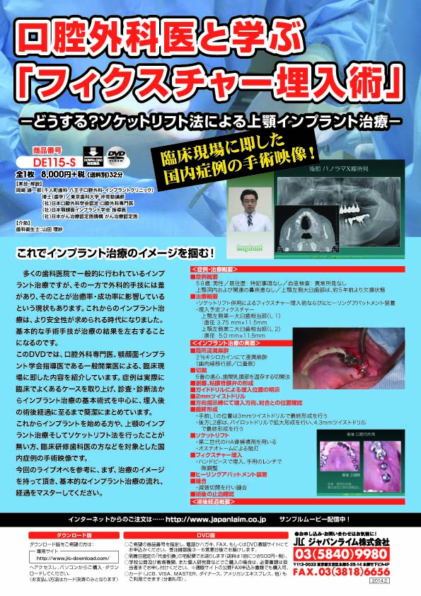 インプラント基本手術DVD 発刊のお知らせ